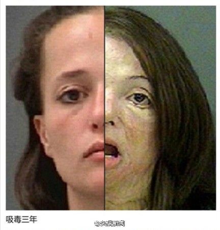 该毒品吸食过量会迅速致幻啃咬他人,易造成不可逆脑部