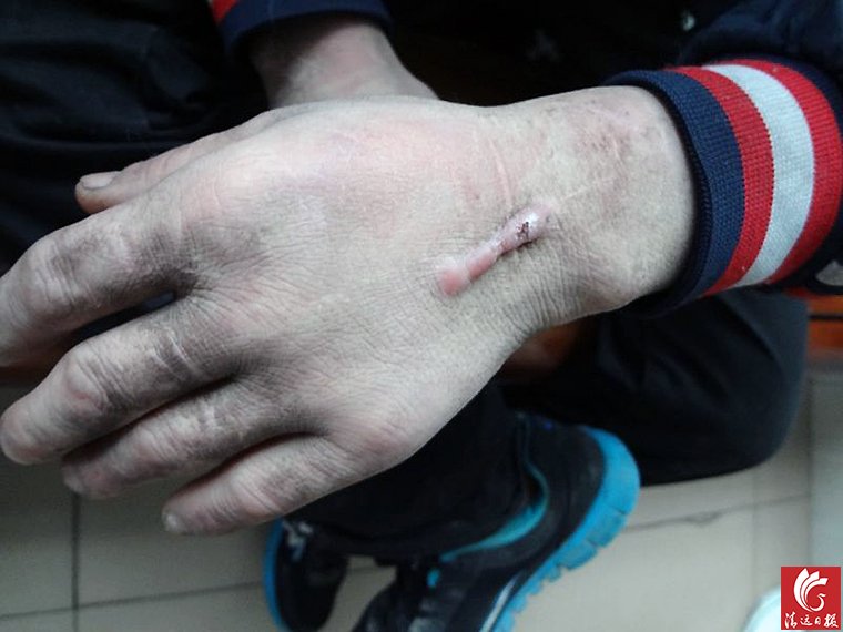 男子遭黑作坊囚禁18年 不知今夕是何年(图)