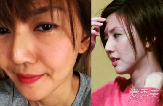 经贸 点击排名      孙燕姿年轻时满脸的痘痘一直困扰她,如今年近四十